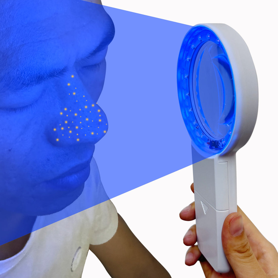 How is a Woods lamp used in cosmetic dermatology?