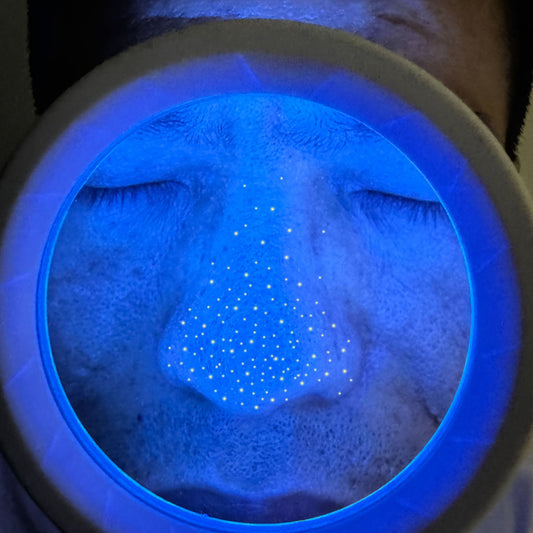 What precautions should be taken when using a Woods lamp?