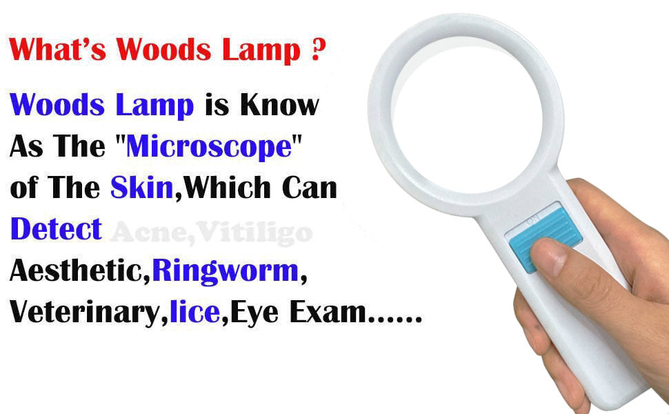What is a Woods lamp?