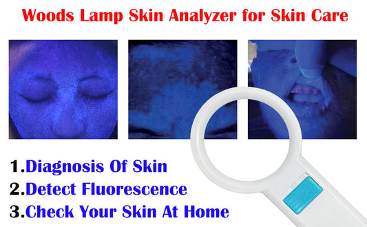 How do you interpret the fluorescence patterns observed under a Woods lamp?