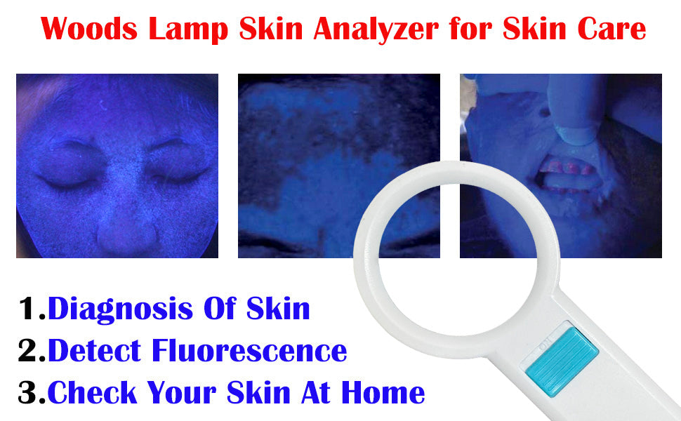 Is a Woods lamp safe for eyes and skin?